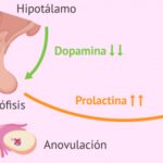 Prolactina
